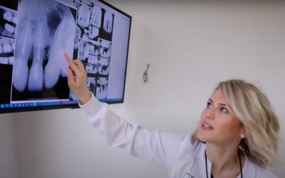 Can Dental Implants Get Stains?